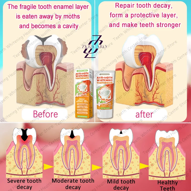 Healthy Teeth Cavity Repair Solution – Supports Tooth Enamel & Oral Care | 99% Repurchase Rate