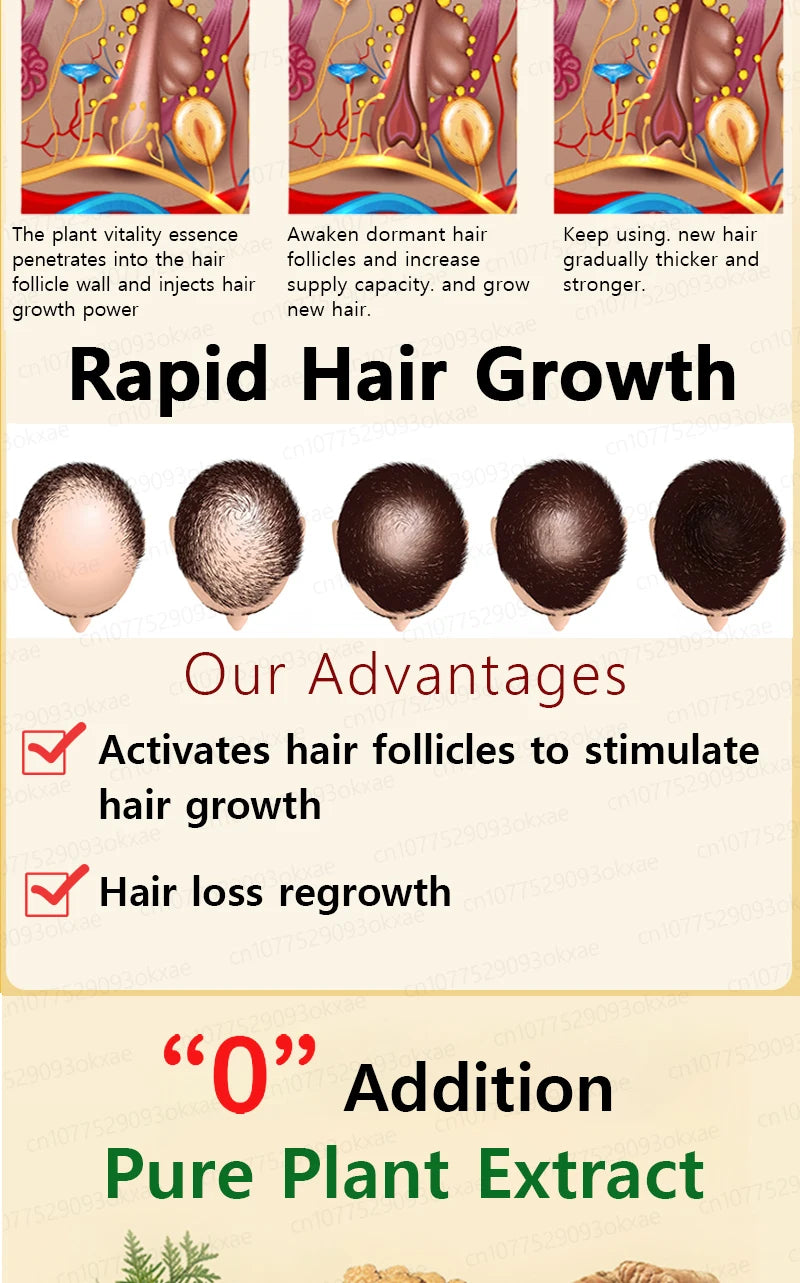 Natural Hair Growth & Hair Loss Control Essential Oil – Unisex Scalp Treatment, 30ml
