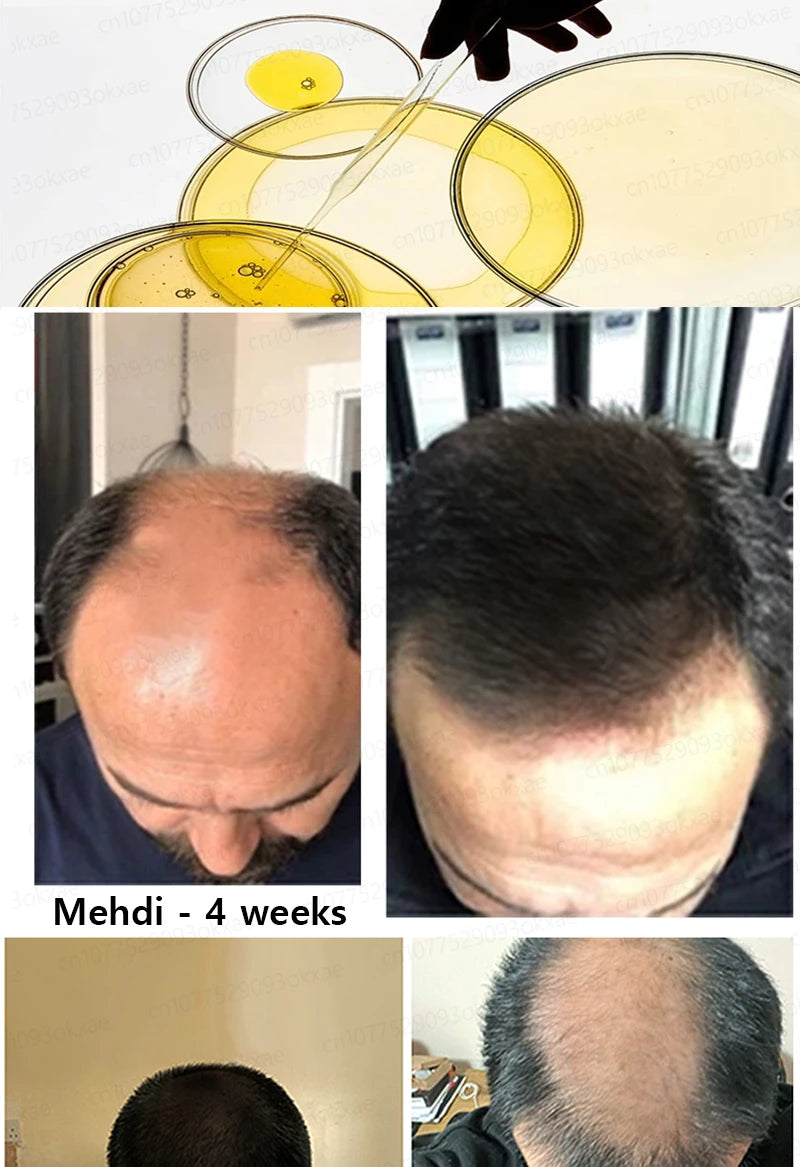 Natural Hair Growth & Hair Loss Control Essential Oil – Unisex Scalp Treatment, 30ml