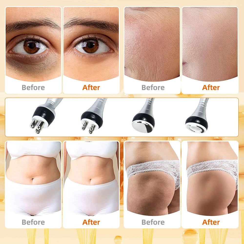 4-in-1 Cavitation Body Slimming & Skin Tightening Machine – Face Lifting, Vacuum Suction, and 40K Beauty Massager