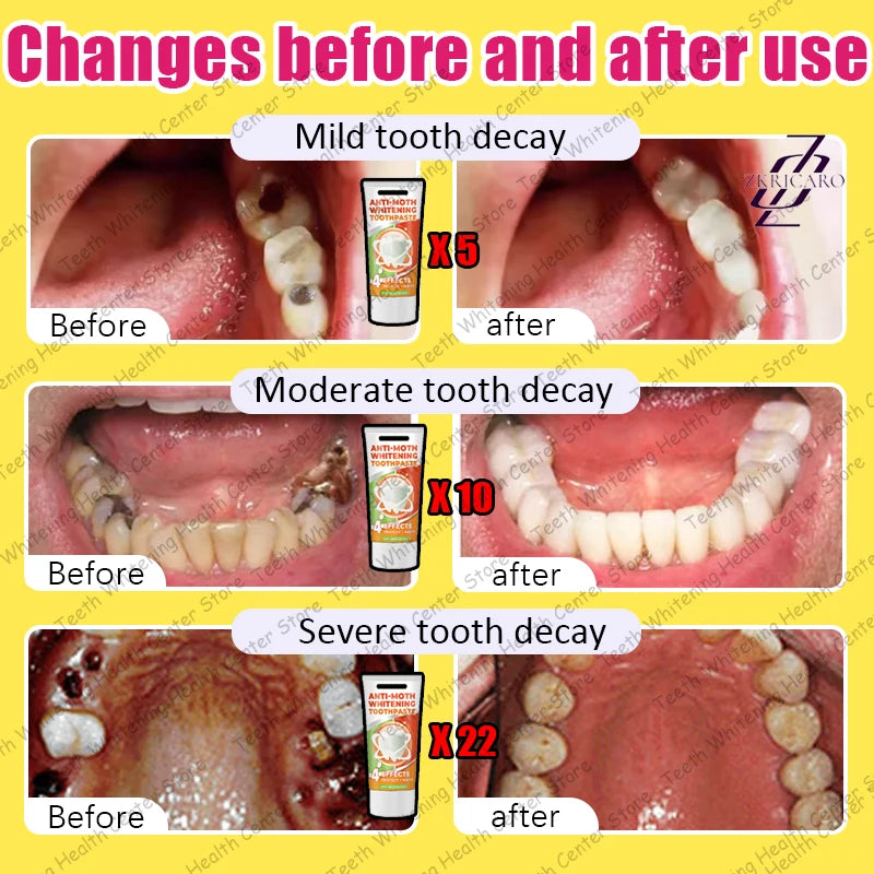 Healthy Teeth Cavity Repair Solution – Supports Tooth Enamel & Oral Care | 99% Repurchase Rate