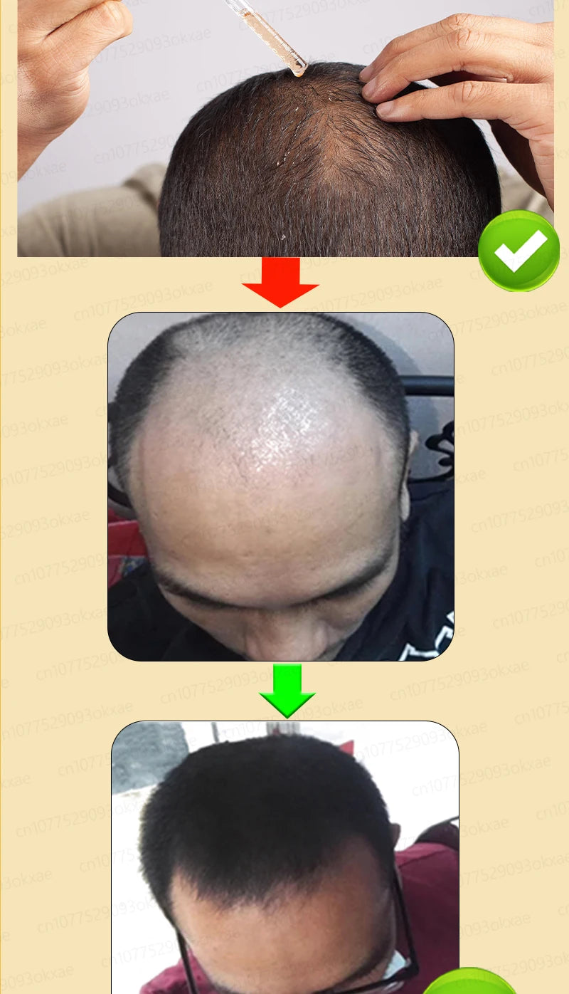 Natural Hair Growth & Hair Loss Control Essential Oil – Unisex Scalp Treatment, 30ml
