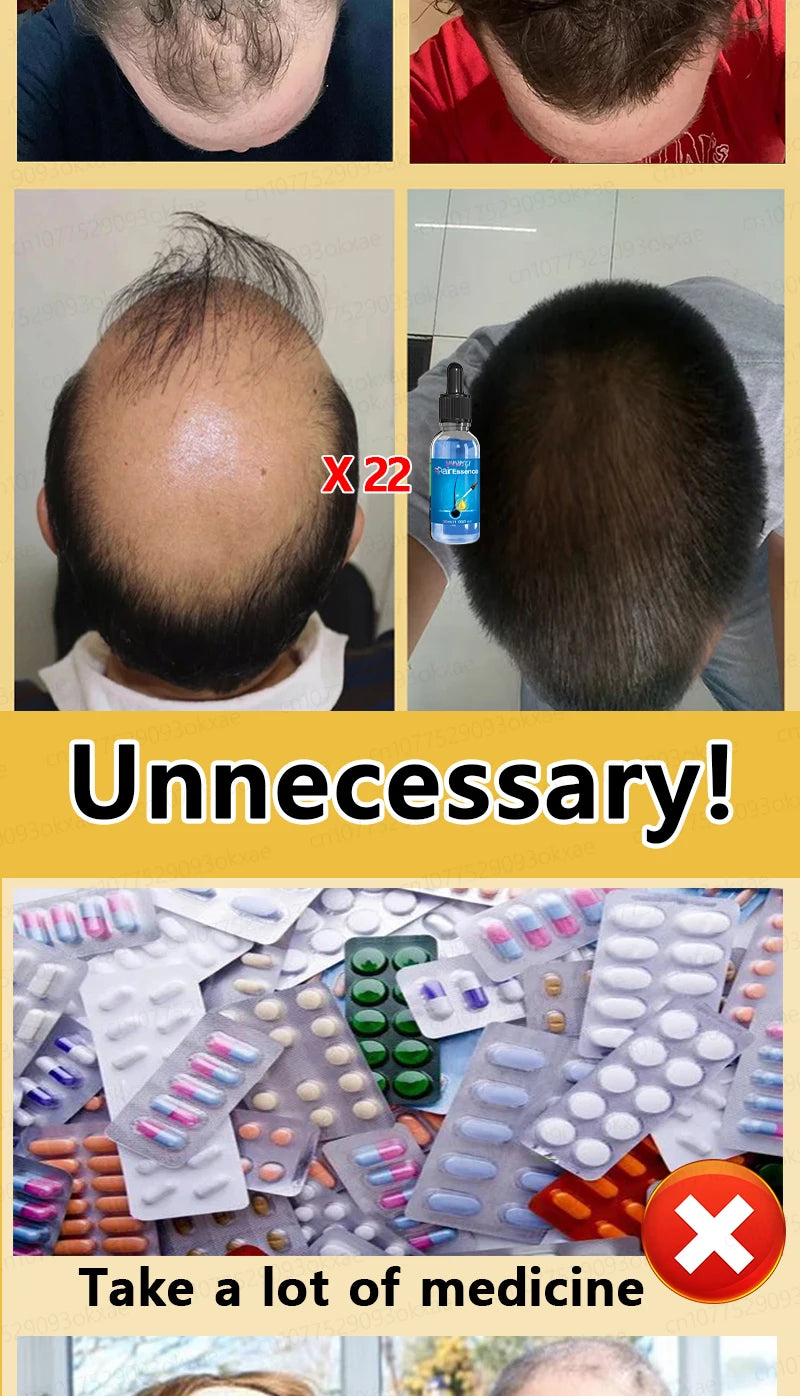 Natural Hair Growth & Hair Loss Control Essential Oil – Unisex Scalp Treatment, 30ml