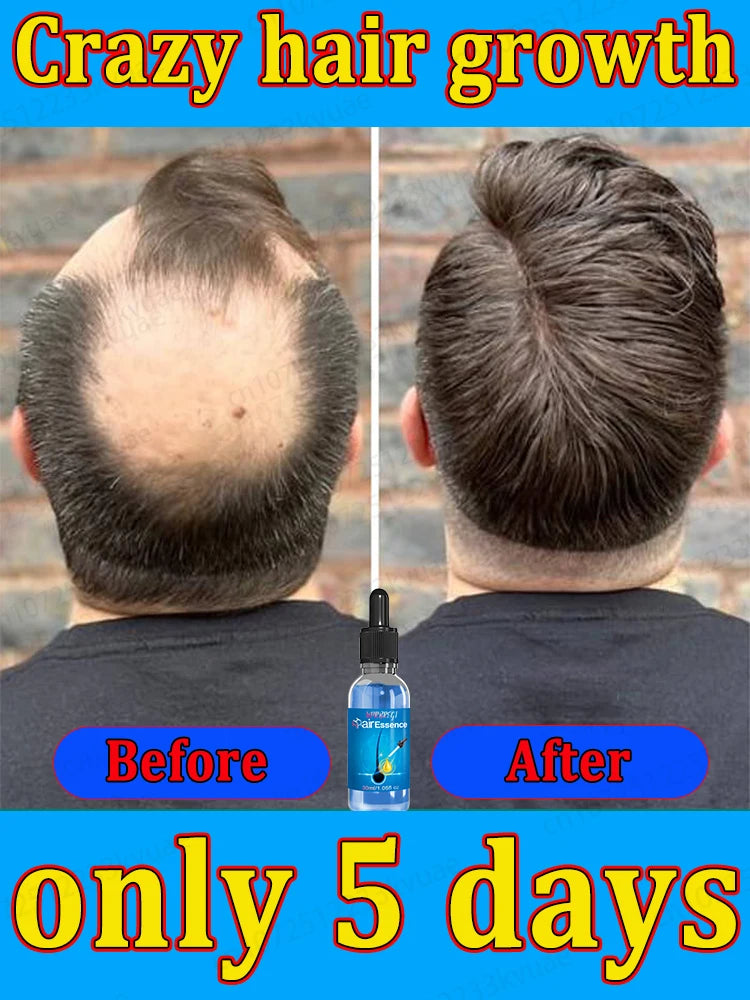 Natural Hair Growth & Hair Loss Control Essential Oil – Unisex Scalp Treatment, 30ml