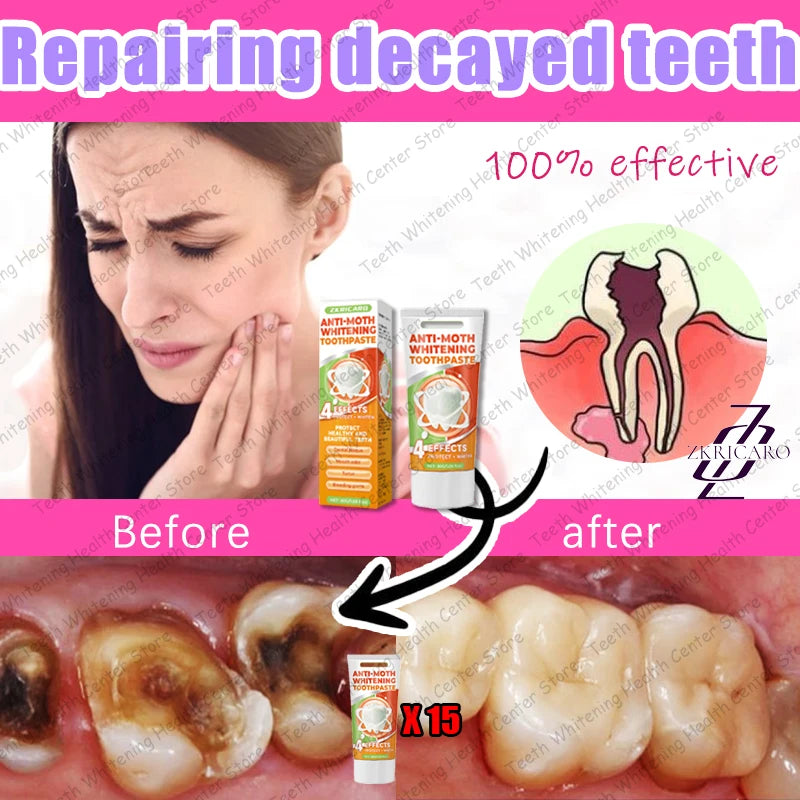 Healthy Teeth Cavity Repair Solution – Supports Tooth Enamel & Oral Care | 99% Repurchase Rate