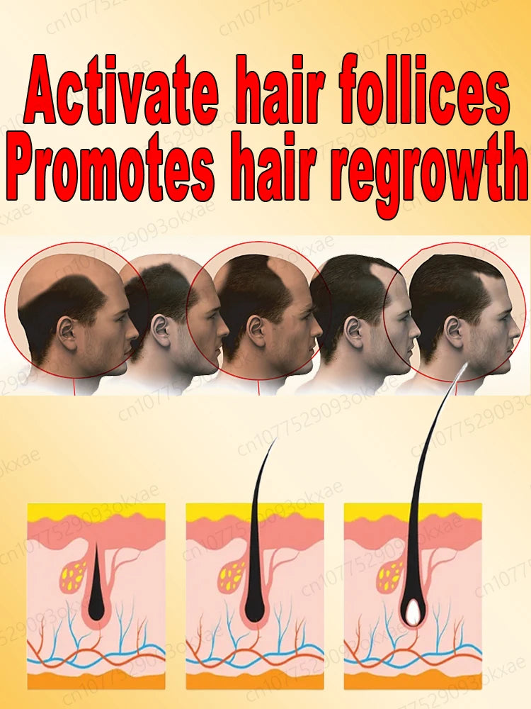 Natural Hair Growth & Hair Loss Control Essential Oil – Unisex Scalp Treatment, 30ml