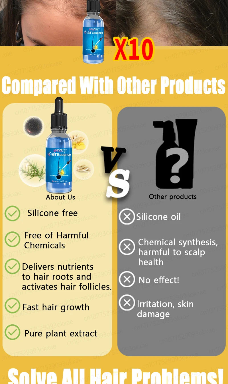 Natural Hair Growth & Hair Loss Control Essential Oil – Unisex Scalp Treatment, 30ml