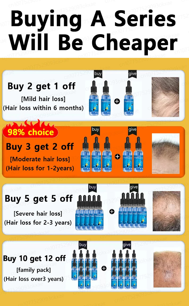 Natural Hair Growth & Hair Loss Control Essential Oil – Unisex Scalp Treatment, 30ml