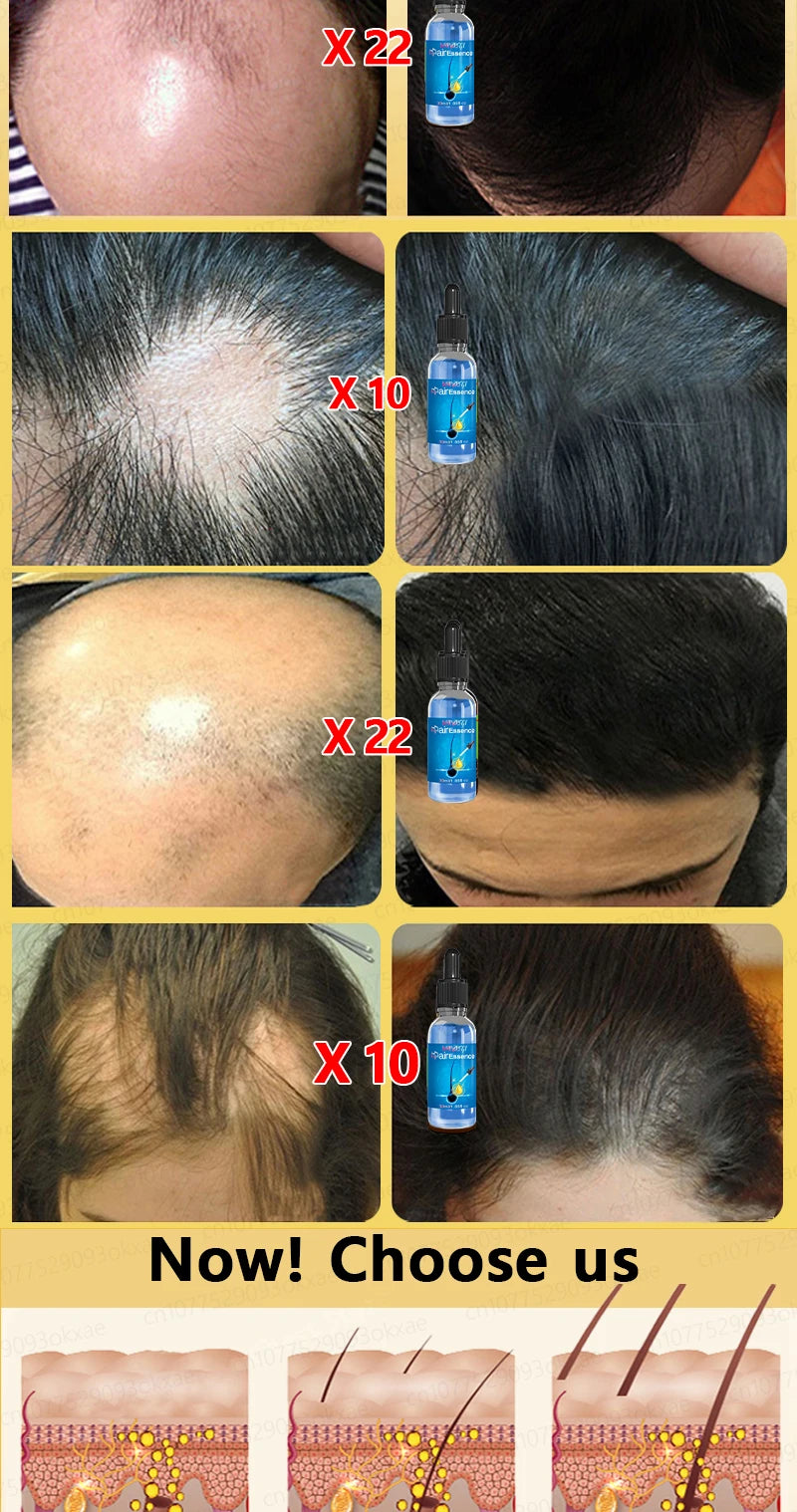 Natural Hair Growth & Hair Loss Control Essential Oil – Unisex Scalp Treatment, 30ml