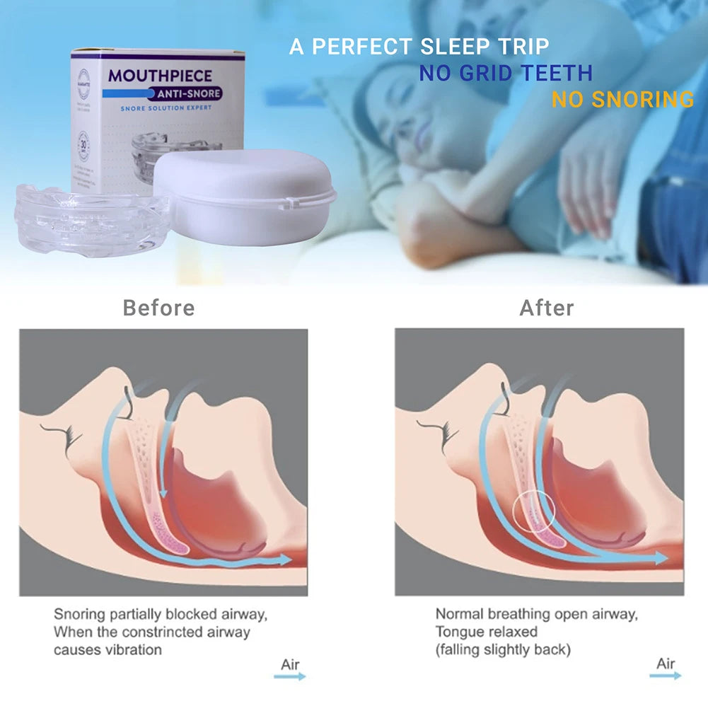 Anti-Snoring Teeth Mouth Guard