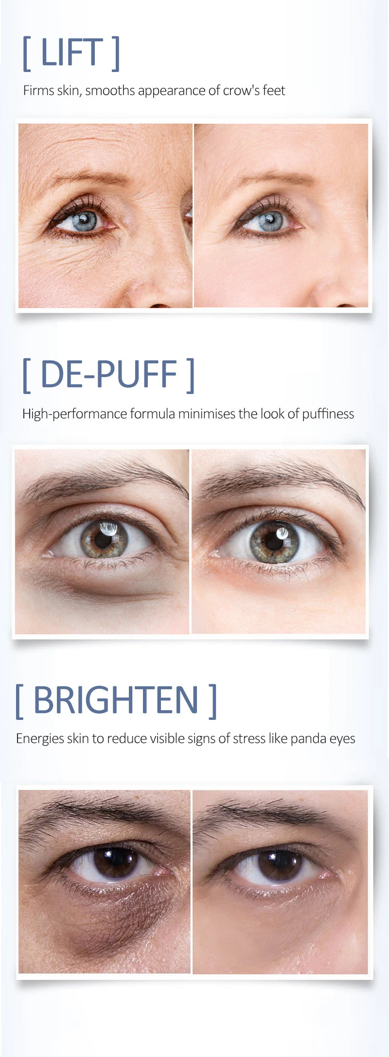 Moisturizing Eye Cream – Anti-Aging, Puffiness & Dark Circle Serum - O’CHEAL Retin-A Ester