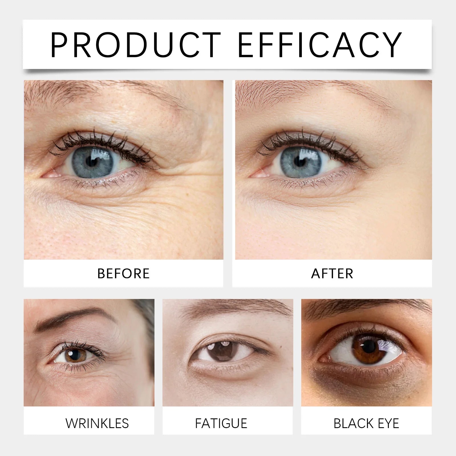 Eye Cream – Dark Circle Lightening & Firming Eye Serum Stick - OUHOE Niacinamide