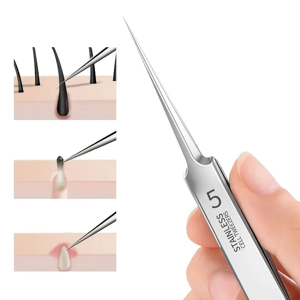 Pack Extra Fine No. 5 Cellular Acne Blackhead Tweezers - Facial Beauty Remove Acne Needle Tools for Skin Care