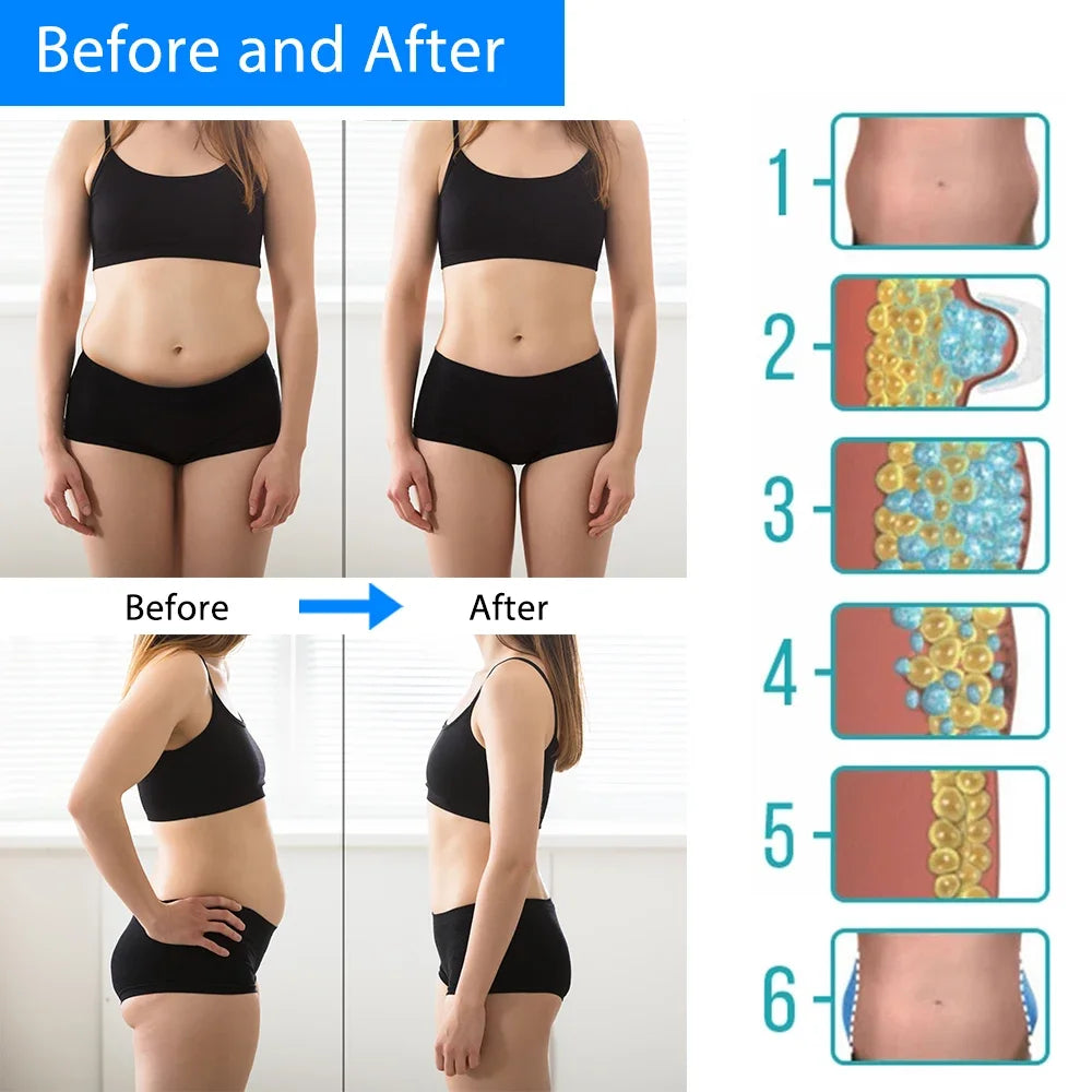 Cryotherapy Fat Dissolving & Anti-Cellulite Massager – Abdominal Lipo Freeze Slimming Machine